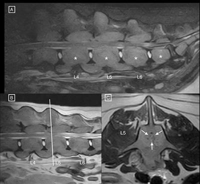 Case Report: Diffuse Lumbar Hyperostosis Causing Vertebral Canal Stenosis in a Dog With Concurrent Multicentric T-Cell Lymphoma